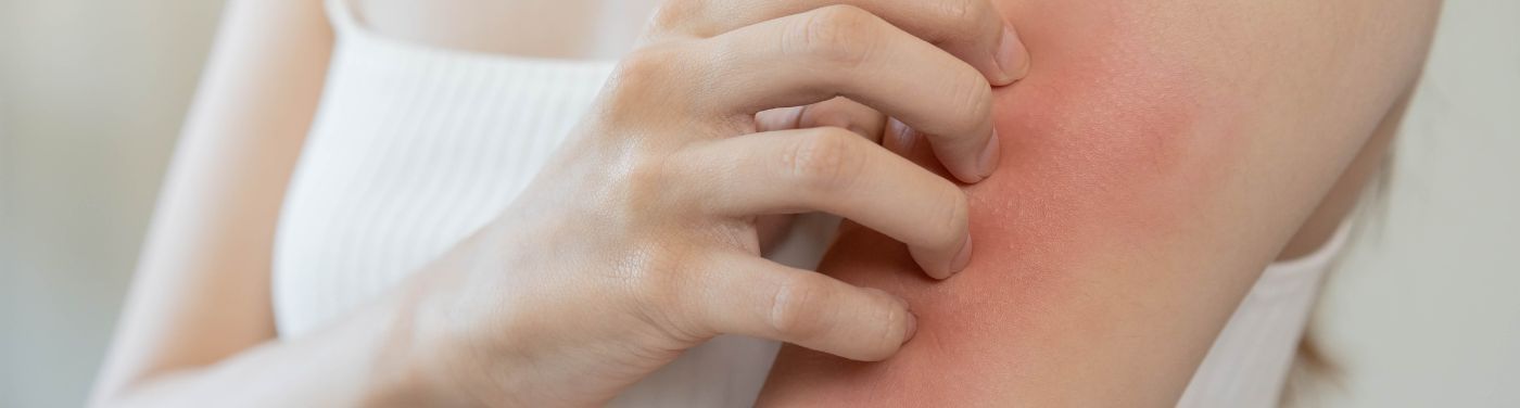 Conheça os sinais de alerta para doenças de pele
