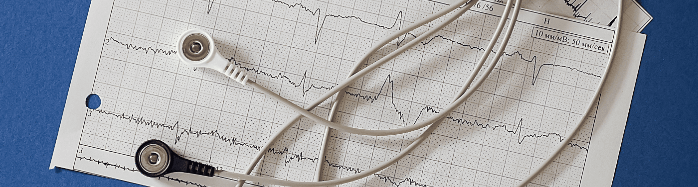 Fibrilação atrial