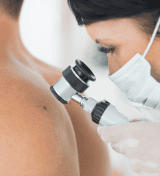 Carcinoma de células escamosas da pele: entenda o que é, causas e sintomas