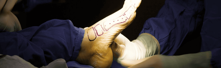 hospital-higienopolis-ortopedia-1300x401-cirurgia-de-pe.png