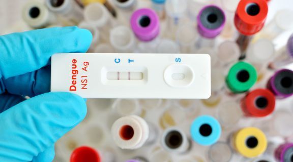 Como é feito o diagnóstico de Dengue e qual é o tratamento