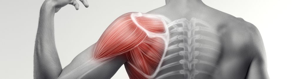 Dor muscular1.jpg