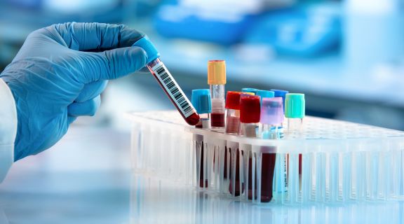 Exame de sangue para detectar câncer