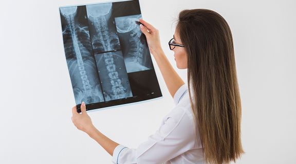 Escoliose: o que é, tipos e tratamentos disponíveis