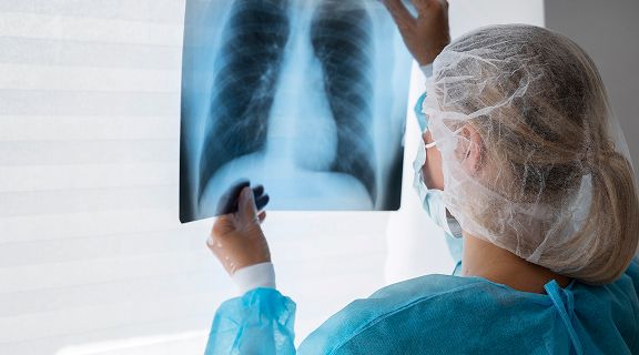 Pneumologista: o que trata e quando consultar