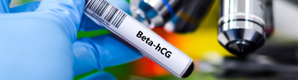 beta hcg precisa de pedido médico​1.jpg
