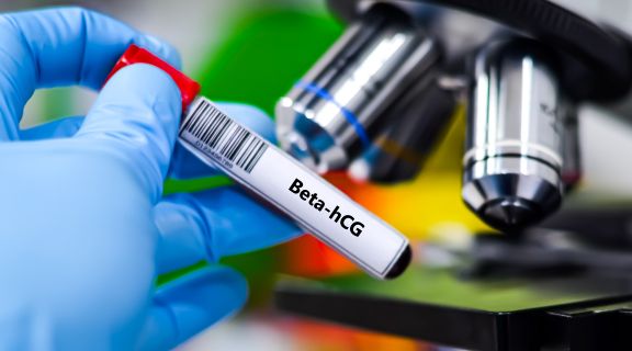 Exame Beta HCG precisa de pedido médico? Entenda quando ele é indicado