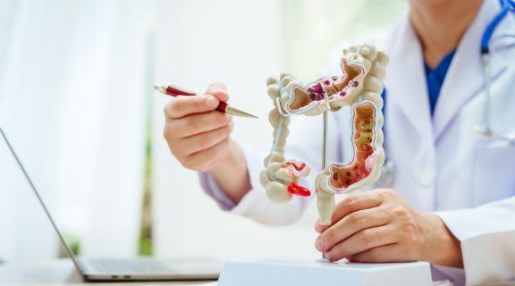   Biópsia do intestino: entenda o que é, como é feita e cuidados essenciais