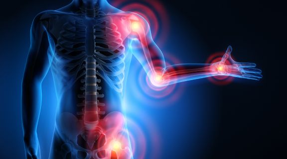 Câncer de medula óssea sintomas: saiba reconhecer os sinais e quando buscar ajuda