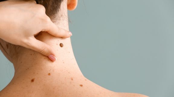  Carcinoma: tratamento e como a melhor opção é escolhida?