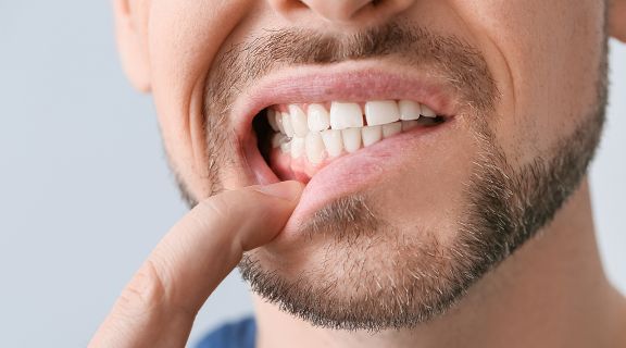 Caroço na gengiva pode ser câncer? Entenda