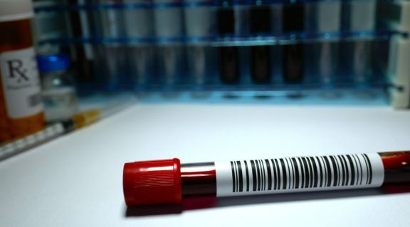   Como identificar a leucemia? Sinais de alerta e exames essenciais para detectar