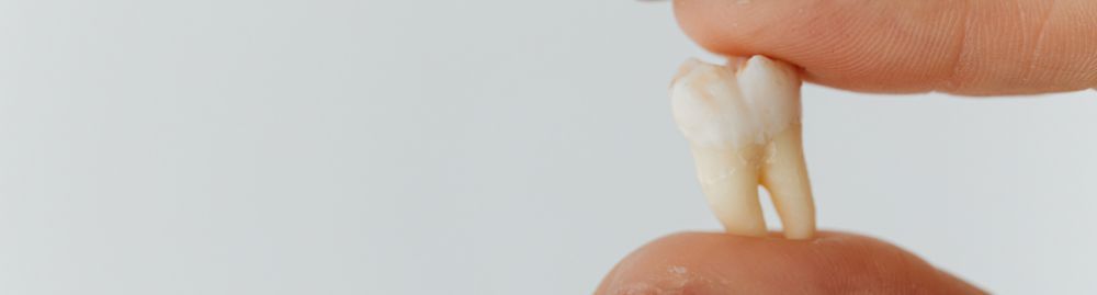 dente de fumante​1.jpg