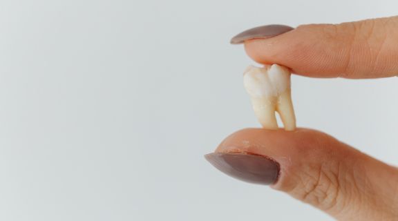 Dente de fumante: o que é, como identificar, tratar e prevenir danos bucais