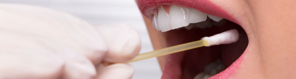 doenças transmitidas pela saliva_1.jpg