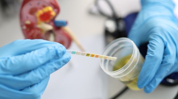   Exame de urina detecta o quê? Entenda quando e para que é solicitado