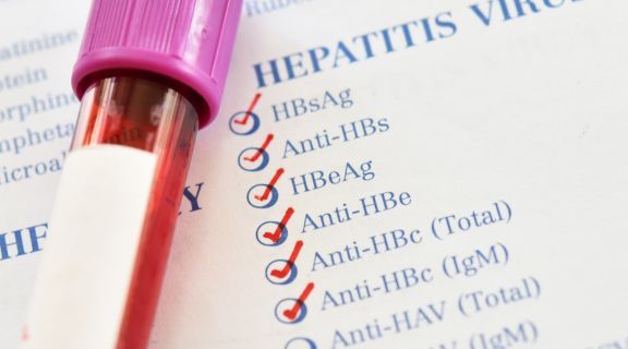 Exames para hepatite B: veja quando é pedido e como entender os resultados