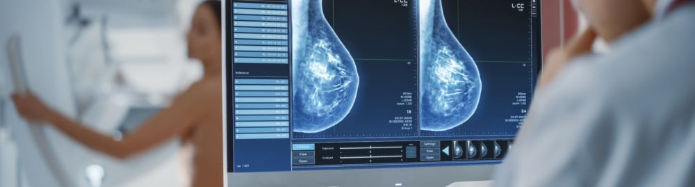 fiz mamografia e o médico pediu ultrassom​1.jpg