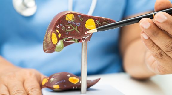 Gastroenterologista cuida do fígado? Entenda qual médico procurar e quando