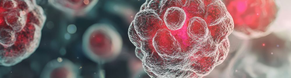 glioblastoma tem cura1.jpg