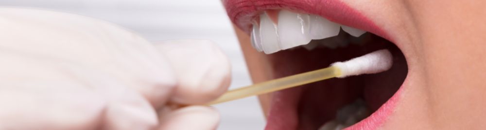 hiv passa por saliva​1.jpg