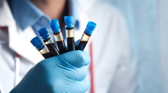 Leucemia aparece no hemograma? Entenda os principais sinais de alerta