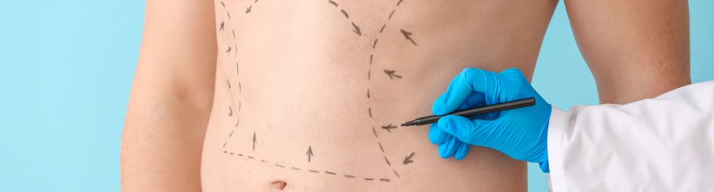 lipo hd masculina​1.jpg