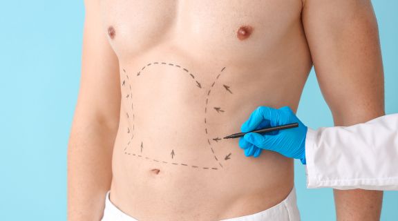 Lipo HD masculina: o guia completo para a definição corporal em homens