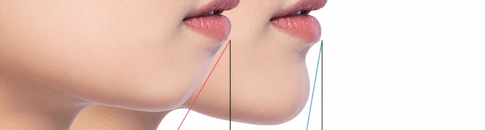 o que é cirurgia ortognática_1.jpg