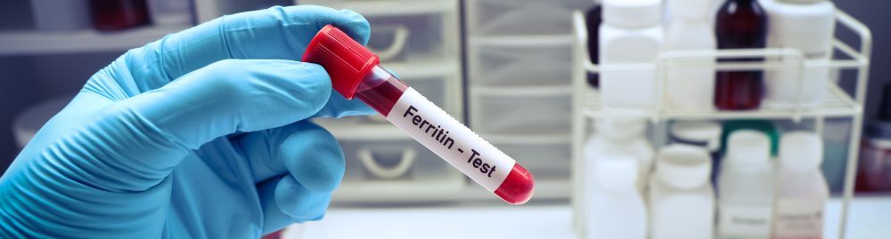 para que serve o exame de ferritina​1.jpg