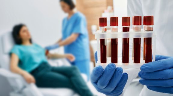 Pode fumar antes de fazer exame de sangue? Veja quais são as recomendações