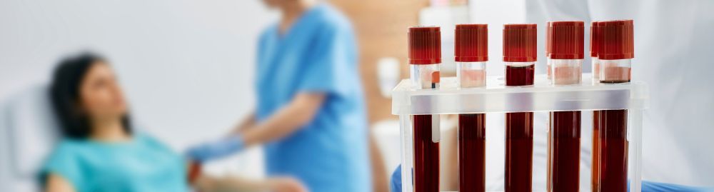 pode fumar antes de fazer exame de sangue​1.jpg