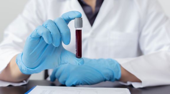 Quais exames não precisam de pedido médico? Saiba o que é permitido ou não