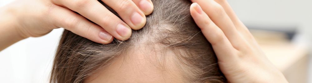 qual a melhor biotina para queda de cabelo1.jpg