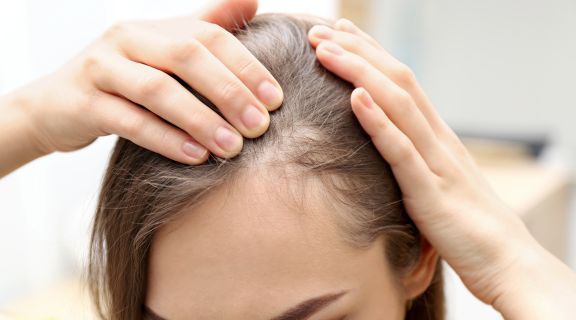 Biotina para queda de cabelo: como saber se é a melhor solução para você?
