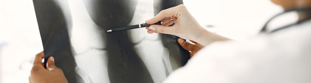 quando a osteoporose é grave1.jpg