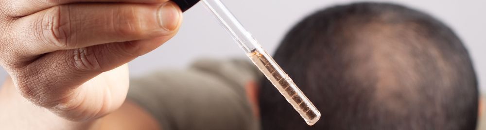 quanto tempo minoxidil faz efeito​1.jpg