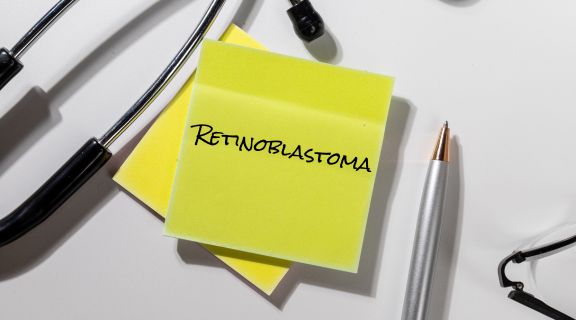 Retinoblastoma infantil: causas, sintomas e diagnóstico
