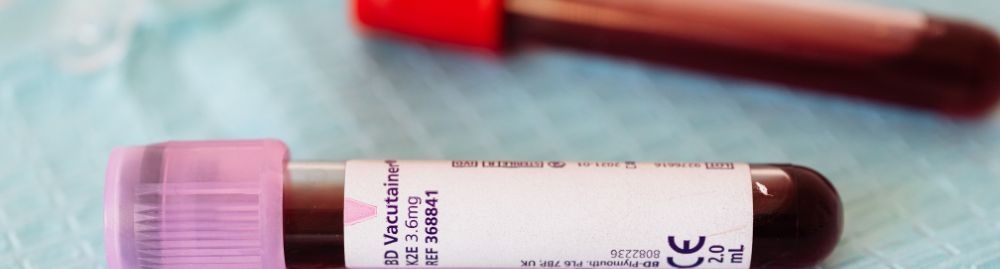 sangue grosso o que significa1.jpg