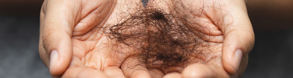 sintomas de eflúvio telógeno​1.jpg