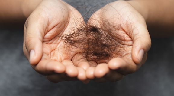 Sintomas de eflúvio telógeno: causas da queda de cabelo intensa e como tratar