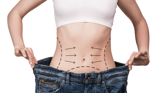 Cirurgia plástica depois de emagrecer: é possível?