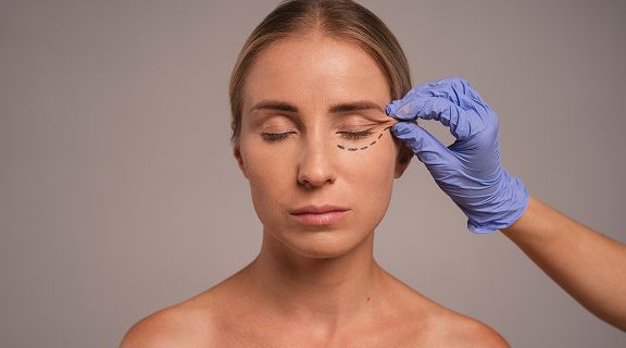 Blefaroplastia: conheça os benefícios dessa cirurgia para as pálpebras