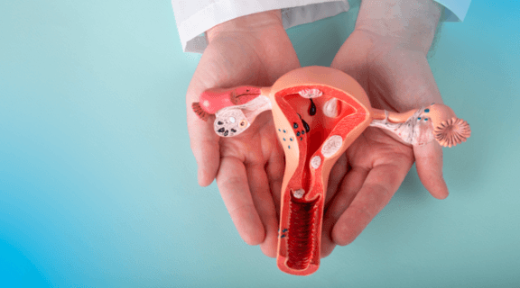 endometrite.png