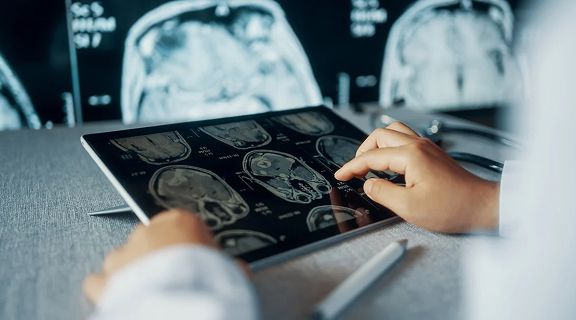 Tomografia: exame produz imagens detalhadas e em alta resolução